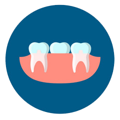 牙龈手术