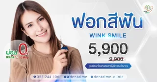 ฟอกสีฟัน Wink Smile ราคา 5,900 บาท ที่ Dentalme Clinic เชียงใหม่ ผ่อน 0% 10 เดือน