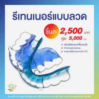 โปรโมชั่นรีเทนเนอร์แบบลวด Dentalme Clinic เชียงใหม่ ราคา 2,500 บาทต่อชิ้น คู่ละ 5,000 บาท