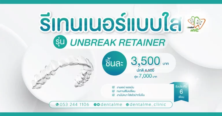 รีเทนเนอร์แบบใส Unbreak Retainer โปรโมชั่น Dentalme Clinic เชียงใหม่ ราคา 3,500 บาท