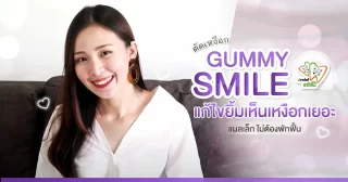 แก้ไขยิ้มเห็นเหงือกเยอะ (Gummy Smile) – Dentalme Clinic เชียงใหม่