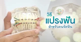 วิธีแปรงฟันสำหรับคนจัดฟัน – Dentalme Clinic เชียงใหม่