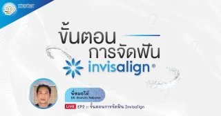 ขั้นตอนการจัดฟัน Invisalign – Dentalme Clinic เชียงใหม่