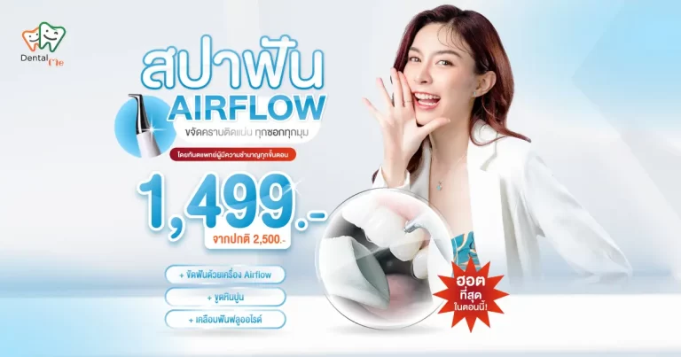 โปรโมชั่นสปาฟัน Airflow ทำความสะอาดฟัน ขจัดคราบติดแน่นทุกซอกมุม ที่ Dentalme Clinic เชียงใหม่ ราคา 1,499 บาท