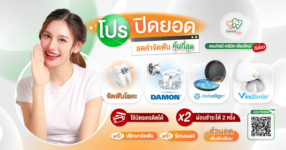 โปรโมชั่นจัดฟันปิดยอด เดนทัลมีคลินิก เชียงใหม่ ลดราคาจัดฟันโลหะ Damon Invisalign VinciSmile