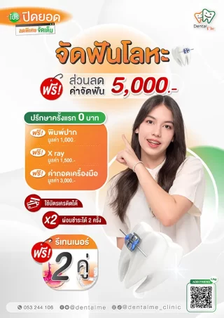 โปรโมชั่นจัดฟันโลหะ ลดค่าจัดฟัน 5,000 บาท เดนทัลมีคลินิก เชียงใหม่