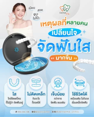 เหตุผลที่ควรเลือกจัดฟันใส Invisalign ที่เชียงใหม่ ใส ไม่ติดเหล็ก เจ็บน้อย ใช้ชีวิตได้ปกติ