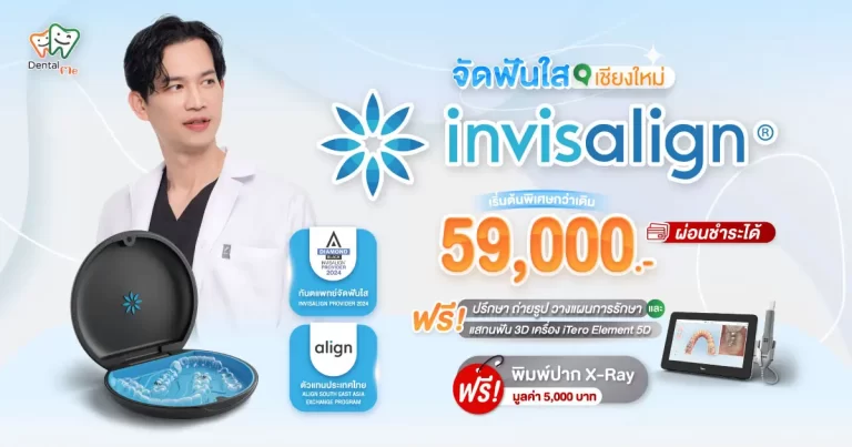 จัดฟันใส Invisalign เชียงใหม่ ราคาเริ่มต้น 59,000 บาท ปรึกษาทันตแพทย์ฟรี พร้อมผ่อนชำระได้