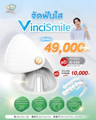 จัดฟันใส VinciSmile โปรโมชั่นเริ่มต้น 49,000 บาท ที่เชียงใหม่ พร้อมฟรีพิมพ์ปากและ X-ray