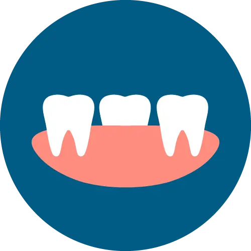 แก้ยิ้มเห็นเหงือก Gummy Smile เชียงใหม่ | Dentalme คลินิกทันตกรรม