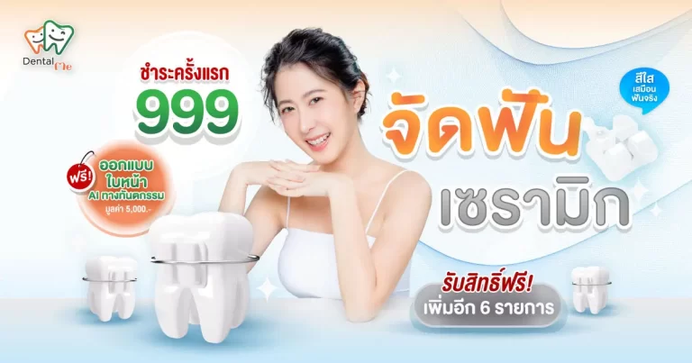ceramic-braces-promotion-dental-me-chiangmai-cover
