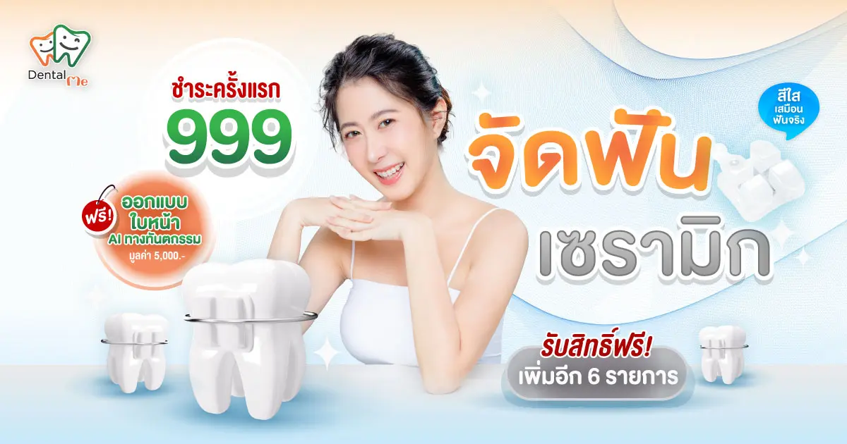 ceramic-braces-promotion-dental-me-chiangmai-cover