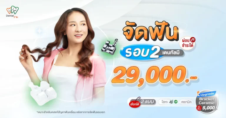 entalme-re-braces-chiang-mai-cover